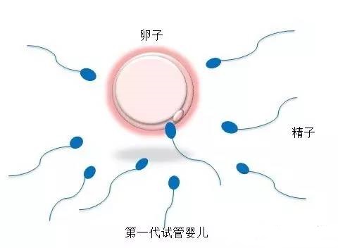 主案例